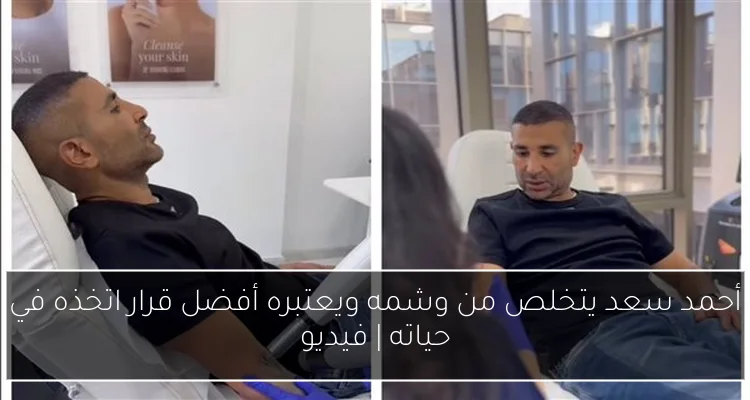 أحمد سعد يتخلص من وشمه ويعتبره أفضل قرار اتخذه في حياته | فيديو