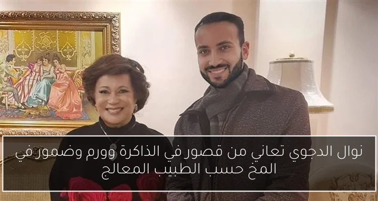 نوال الدجوي تعاني من قصور في الذاكرة وورم وضمور في المخ حسب الطبيب المعالج