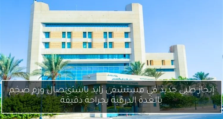 إنجاز طبي جديد في مستشفى زايد باستئصال ورم ضخم بالغدة الدرقية بجراحة دقيقة