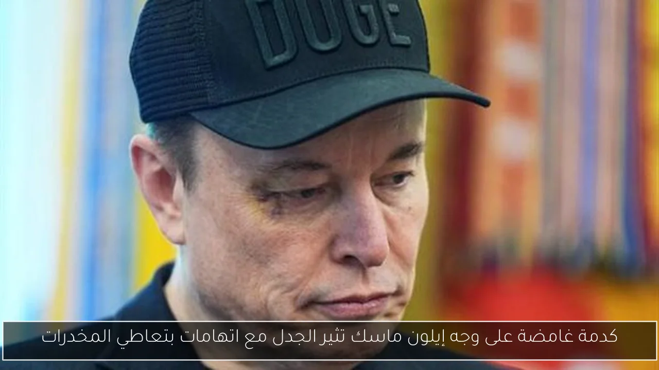 كدمة غامضة على وجه إيلون ماسك تثير الجدل مع اتهامات بتعاطي المخدرات