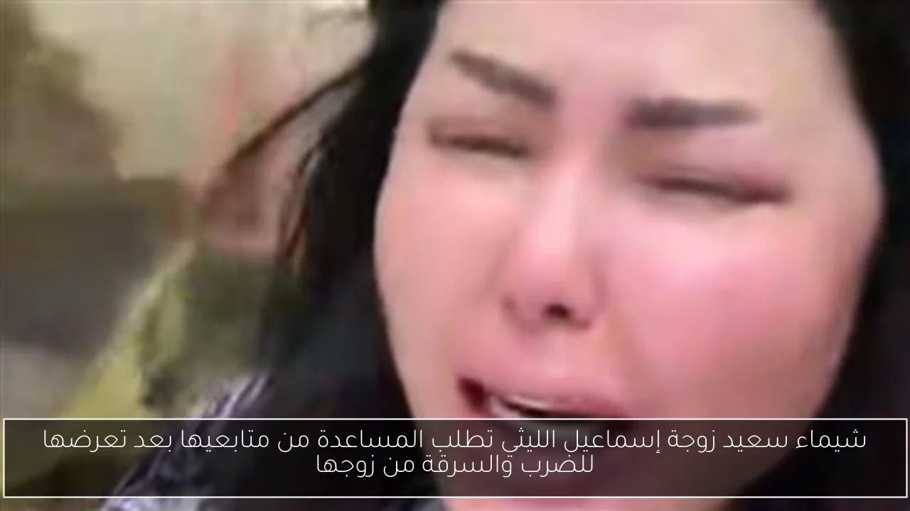شيماء سعيد زوجة إسماعيل الليثي تطلب المساعدة من متابعيها بعد تعرضها للضرب والسرقة من زوجها