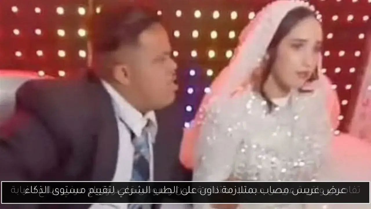 عرض عريس مصاب بمتلازمة داون على الطب الشرعي لتقييم مستوى الذكاء