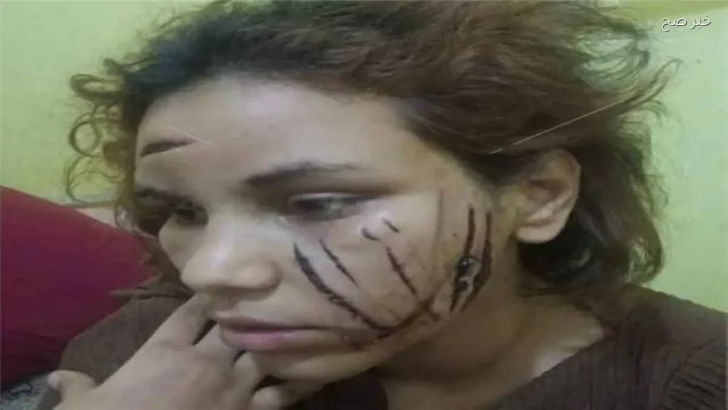 حبس زوج متهم بتعذيب زوجته في شبرا الخيمة 4 أيام